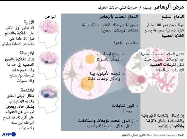 مرض ألزهايمر يسهم في حدوث حالات الخرف  20221130113606infp-afp_32wf6uc-1.h