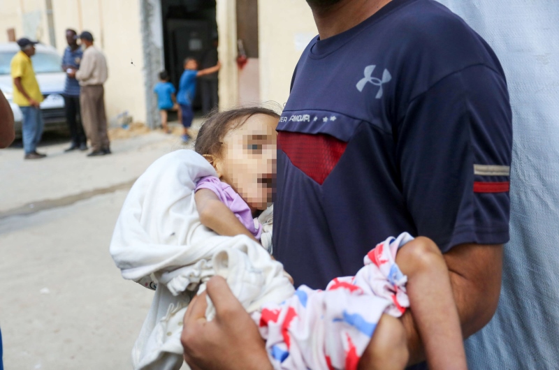 وفاة طفلة فلسطينية بسبب سوء التغذية في غزة