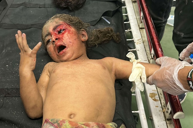 صحة غزة والصليب الأحمر يشرعان بحصر حالات الإعاقة ومبتوري الأطراف